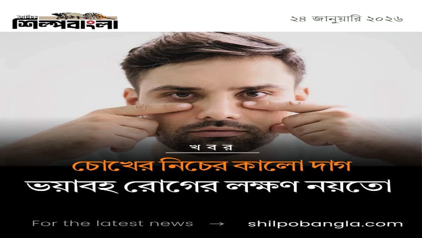 চোখের নিচের কালো দাগ কখন ভয়াবহ রোগের লক্ষণ? যা বলছে গবেষণা